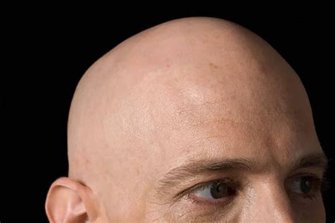 How would i look bald. Things To Know About How would i look bald. 